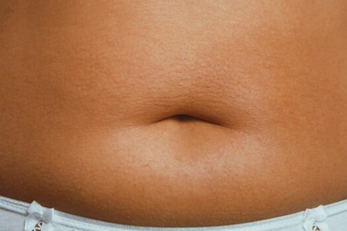 Weight Loss: Avoid these Nigerian foods to help burn belly fat