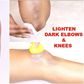 Here are 5 ways to naturally get rid of dark elbows and knees