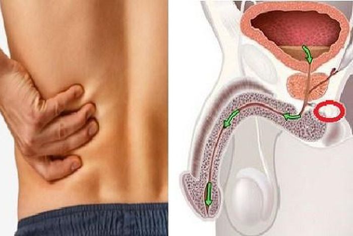 5 early symptoms of cancer in men