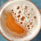 Foamy urine(Northwestern Medicine)