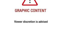 You are about to view picture(s) that may be disturbing.