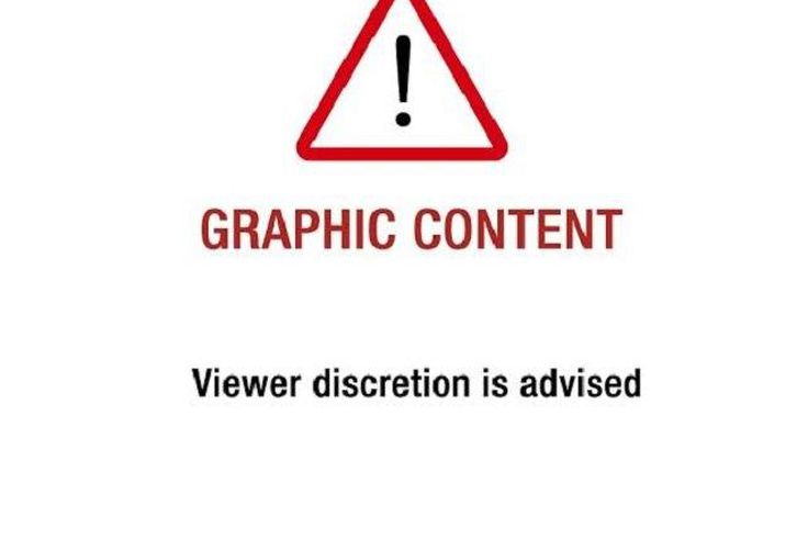 You are about to view picture(s) that may be disturbing.