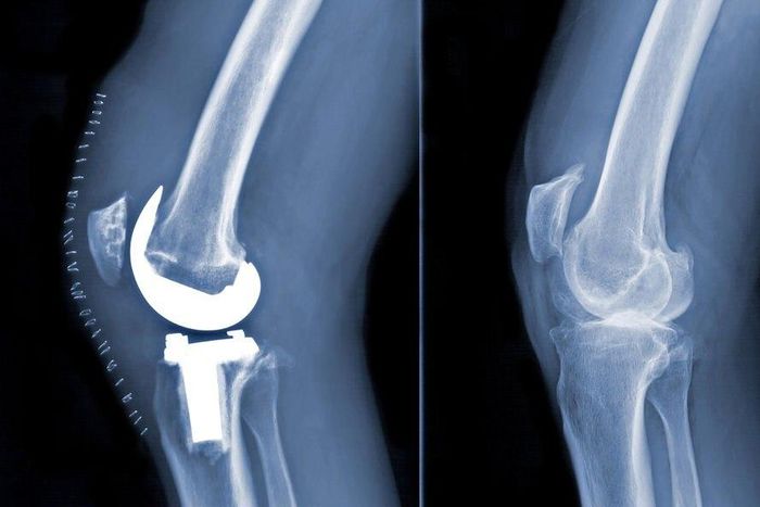 ___8865906___2018___9___17___17___18up-healthbundle1-jumbo