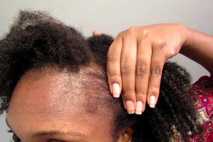 ___8227781___2018___4___9___16___Edges+Regrow+your+hair+guide