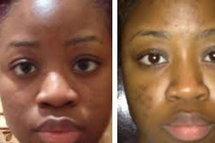 5 natural ways to remove black spots at home