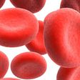 Anaemia: Nigerian foods that can increase red blood cells