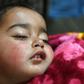 Hiba Jan was hit by a pellet fired from a pump-action gun in Kashmir