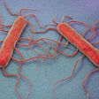 A microscopic image of listeriosis