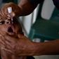 Six-year-old Warapnong Ponde is given a polio vaccination in a mobile clinic in rural Papua New Guinea, as the impoverished country fights a new outbreak of a disease which had previously been eradicated