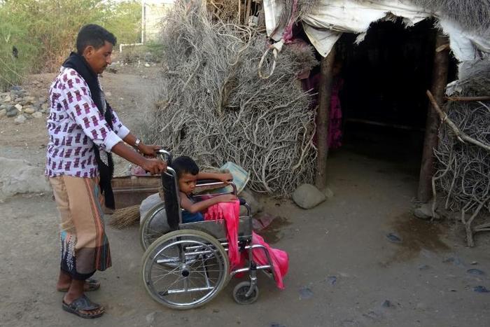 Abdullah, 7, was wounded by a landmine in Yemen's western province of Taez