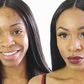 Ance Scars and other blemishes can be perfectly concealed with makeup but they are better treated