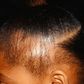 5 natural ways to treat and prevent hair loss