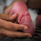 The breakthrough operation, performed in 2016 in Brazil, shows that uterus transplants are feasible and could help thousands of women unable to have children due to uterine problems
