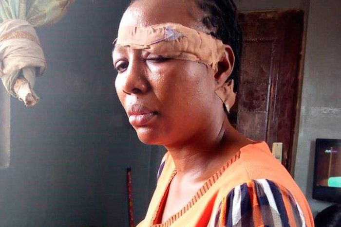 A woman protested again a physical abuse by husband by stabbing him in return.