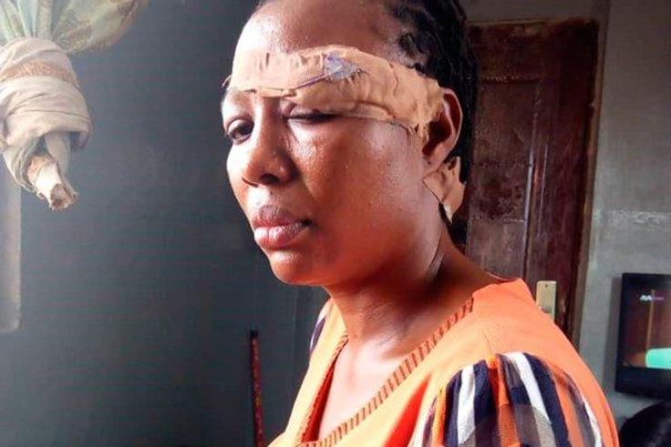 A woman protested again a physical abuse by husband by stabbing him in return.