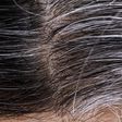 Premature Gray Hair: Here is how to reverse this condition naturally