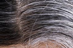 Premature Gray Hair: Here is how to reverse this condition naturally