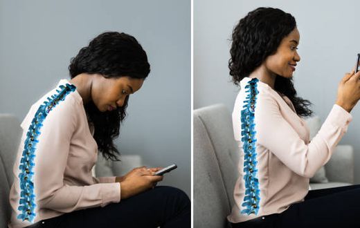 This is what your phone is doing to your posture, and it’s not cute