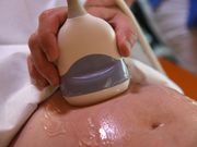 Fausse couche : qu'est-ce que l'expulsion du sac embryonnaire ?