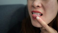 Le cancer de la langue : Qu'est ce que c'est?
