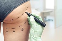 Tout ce qu'il faut savoir sur la chirurgie esthétique!