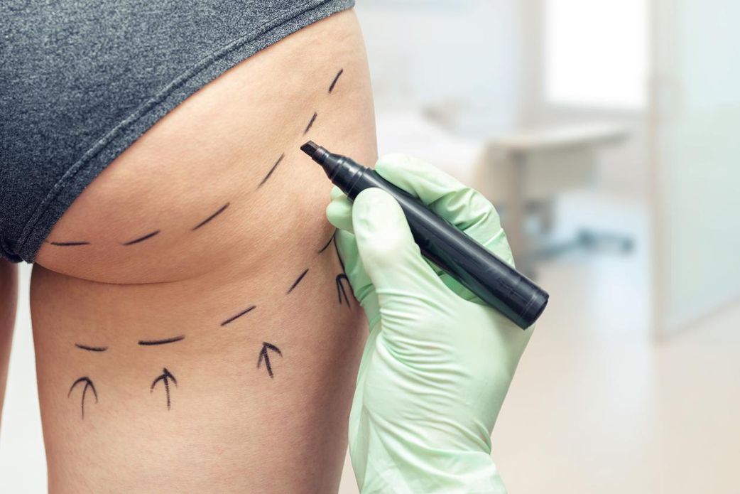 Tout ce qu'il faut savoir sur la chirurgie esthétique!