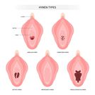 Affaire du couple qui vendait des capsules d'hymen artificiel : l'épouse tombe en transe après la condamnation