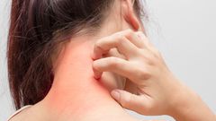 Le psoriasis qu'est ce que c'est?