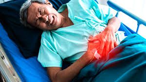 Le cancer du colon (cancer colorectal)