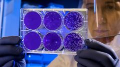 Des scientifiques découvrent un "troisième état" entre la vie et la mort