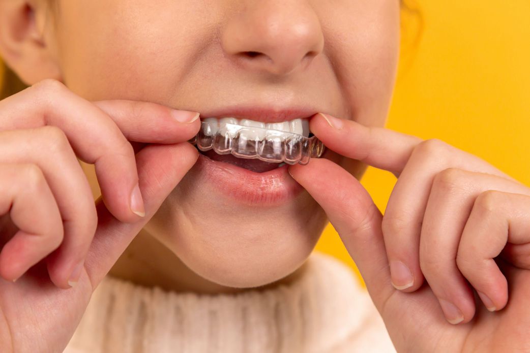 Rétrognathie : que faire en cas de dents en avant ?