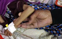 Diabète de type 5 : ce nouveau diabète lié à la malnutrition !