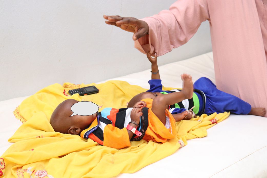 Bambey/ des triplés malnutris frôlent le kwashiorkor : le S.O.S d'une maman de 19 ans