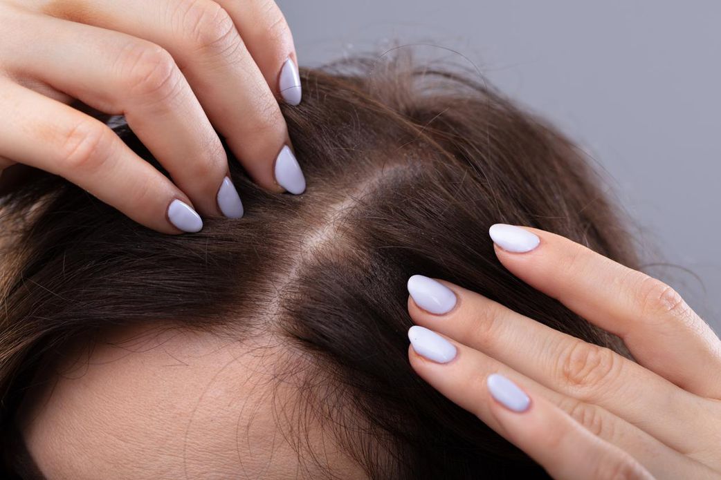 Pourquoi je perds mes cheveux à la ménopause ? Que faire ?