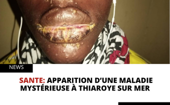 Apparition d’une maladie mystérieuse à Thiaroye sur mer