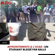 AFFRONTEMENTS A L'UCAD : UN ÉTUDIANT BLESSÉ PAR BALLE