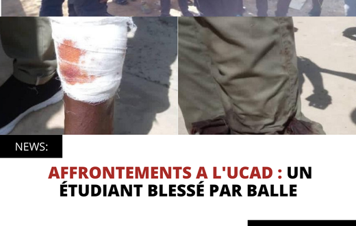 AFFRONTEMENTS A L'UCAD : UN ÉTUDIANT BLESSÉ PAR BALLE