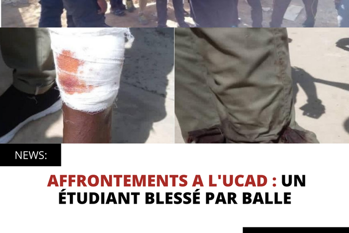 AFFRONTEMENTS A L'UCAD : UN ÉTUDIANT BLESSÉ PAR BALLE