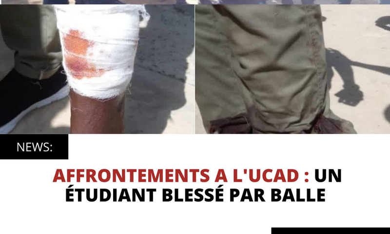 AFFRONTEMENTS A L'UCAD : UN ÉTUDIANT BLESSÉ PAR BALLE