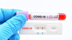 COVID 19: TROIS FOIS PLUS DE PATIENTS GUÉRIS QUE DE NOUVELLES CONTAMINATIONS !