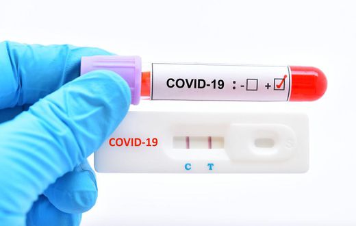 COVID 19: TROIS FOIS PLUS DE PATIENTS GUÉRIS QUE DE NOUVELLES CONTAMINATIONS !