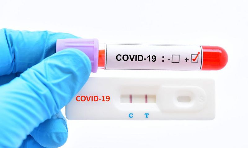 COVID 19: TROIS FOIS PLUS DE PATIENTS GUÉRIS QUE DE NOUVELLES CONTAMINATIONS !