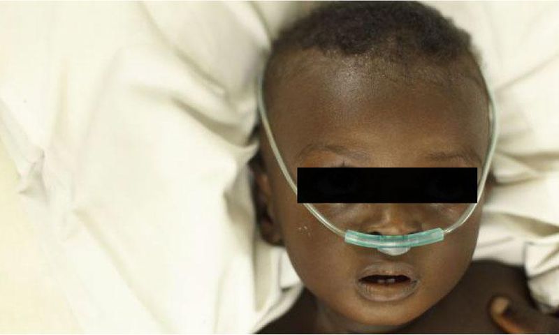 pneumonie-enfant-senegal