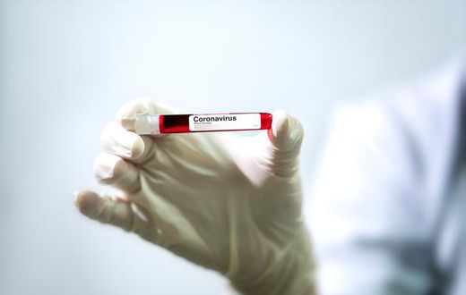 COVID-19 : BAISSE DES NOUVEAUX CAS ET DEUX DÉCÈS SUPPLÉMENTAIRES