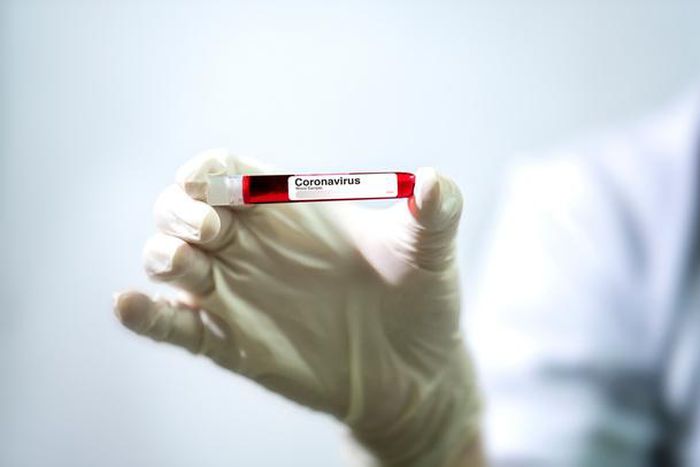 COVID-19 : BAISSE DES NOUVEAUX CAS ET DEUX DÉCÈS SUPPLÉMENTAIRES