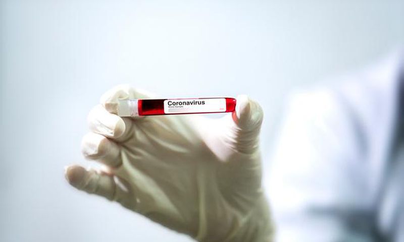 COVID-19 : BAISSE DES NOUVEAUX CAS ET DEUX DÉCÈS SUPPLÉMENTAIRES