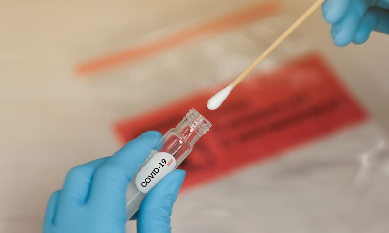 COVID-19 : 7 NOUVEAUX CAS DÉTECTÉS, ZÉRO DÉCÈS, AUCUN CAS IMPORTÉ