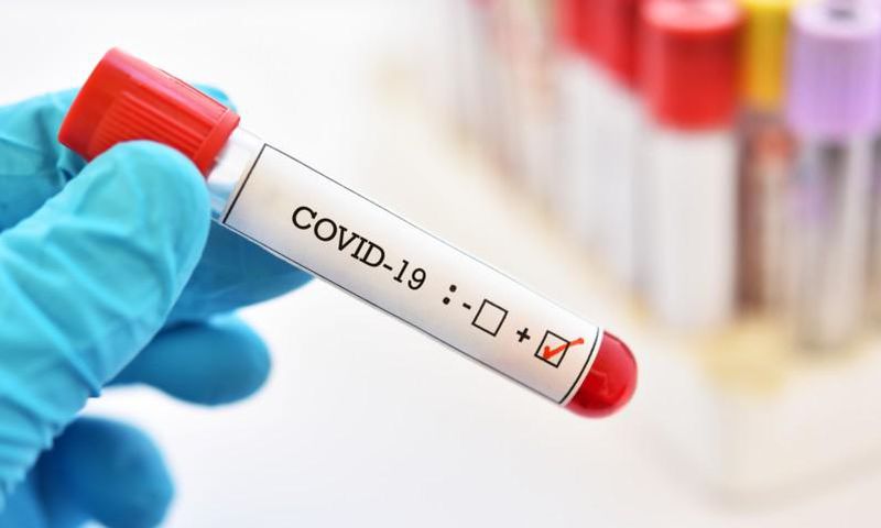 CORONAVIRUS : 137 NOUVEAUX CAS, 4 DÉCÈS DE PLUS, 45 CAS GRAVES, RECORD DE CAS COMMUNAUTAIRES À ZIGUINCHOR...