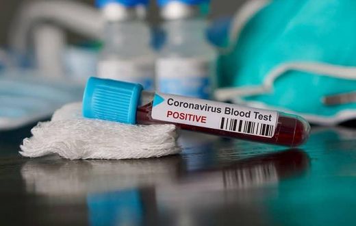 Covid-19 : 73 nouveaux cas dont 5 cas communautaires, 57 guéris, 9 cas graves, 1453 patients sous traitement
