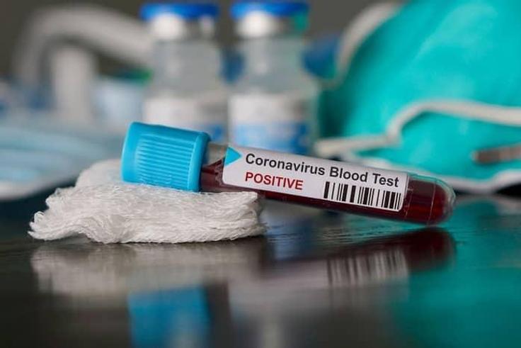 Covid-19 : 66 personnes testées positives, un nouveaux cas grave en réanimation
